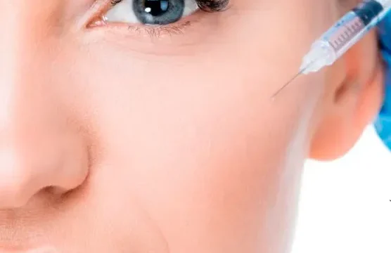 Aumento de pómulos con ácido hialurónico en Málaga: Precisión y resultados naturales