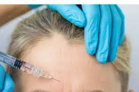 ✨ Tecnología y Precisión: El Rol de la Aparatología Moderna en el Tratamiento de Arrugas de Expresión